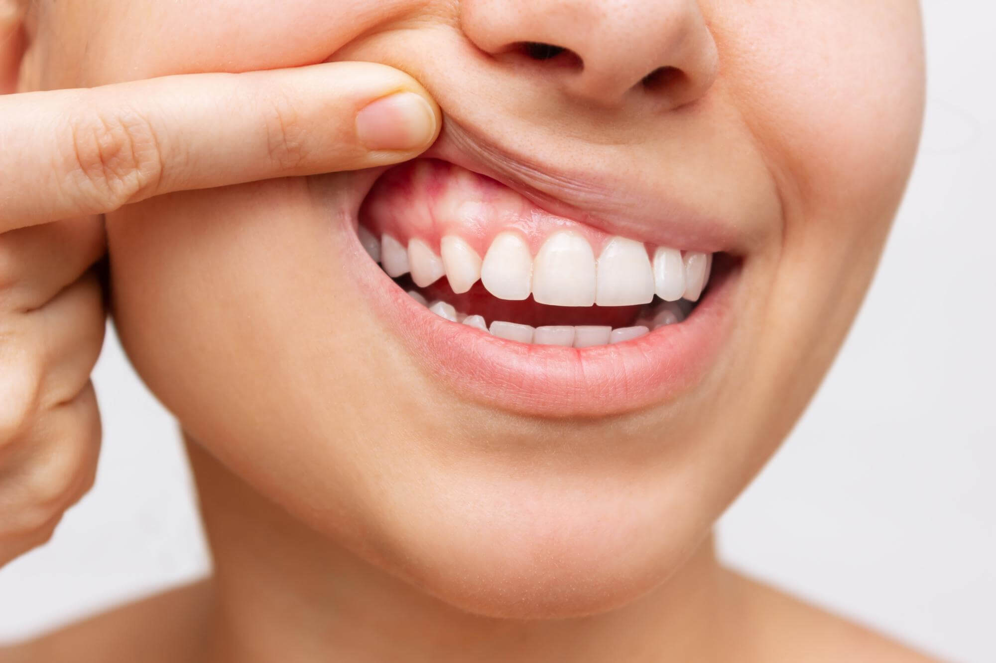 $variable({"type":"content","value":{"name":"site_title","settings":{"before":"Achieve your best smile at ","after":""}}})$