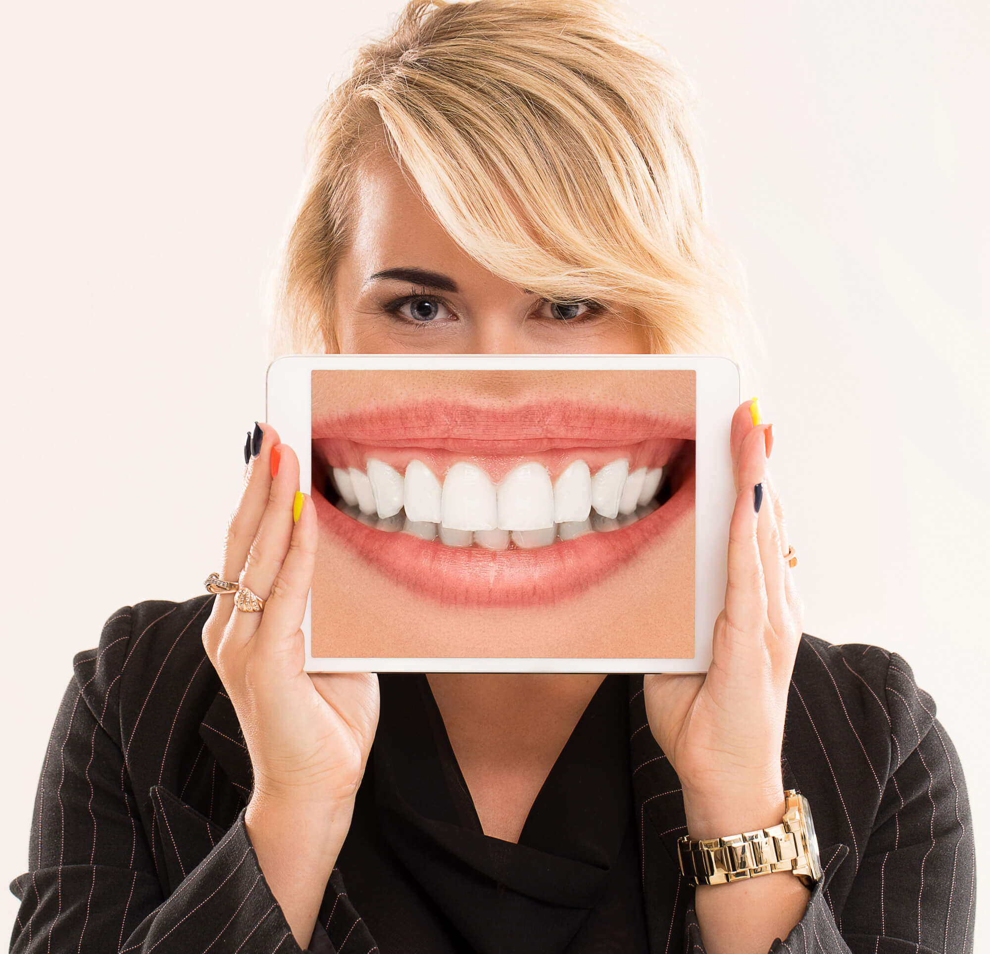 woman showing whiter teeth
