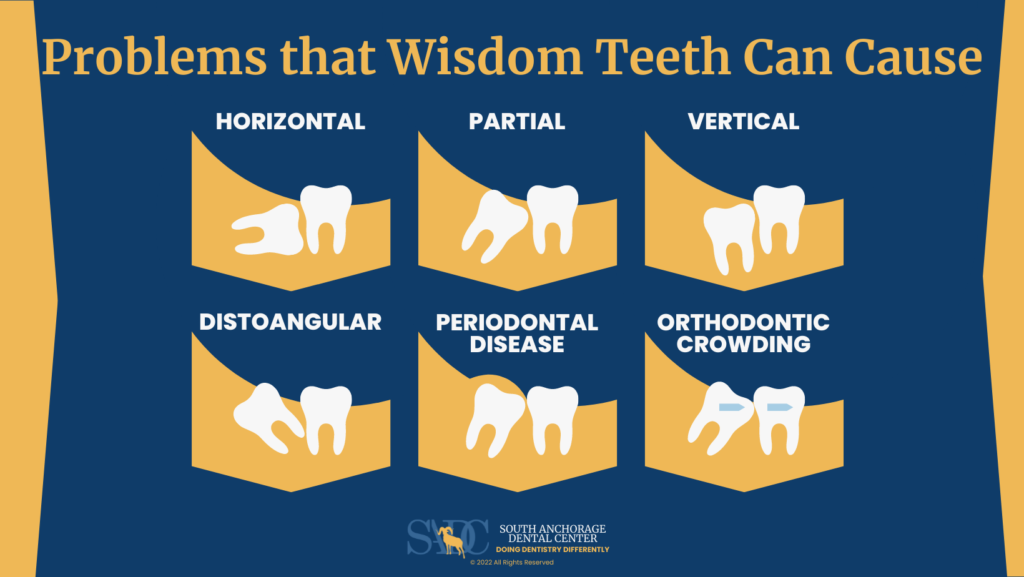 Problems that Wisdom Teeth Can Cause Infographic