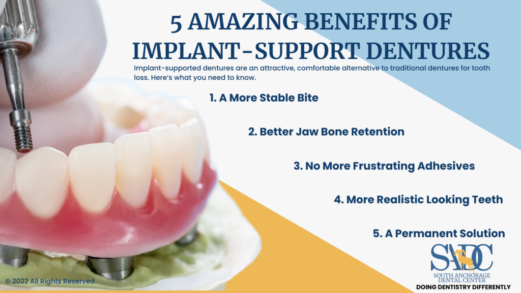 5 Amazing Benefits of Implant-Support Dentures Infographic