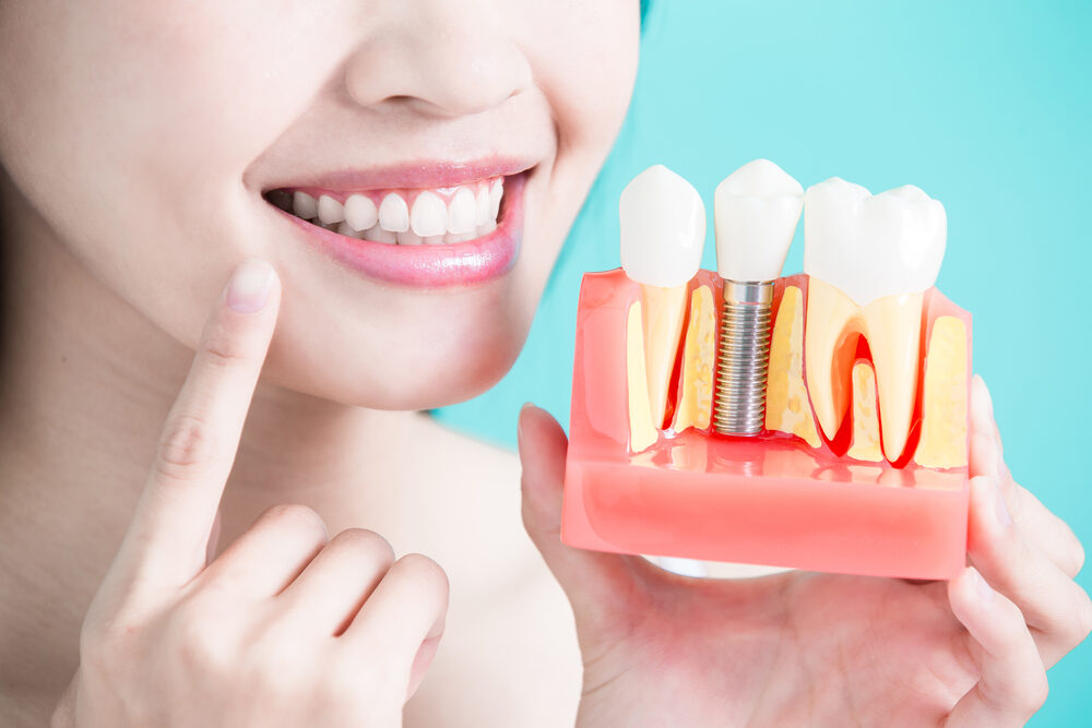 $variable({"type":"content","value":{"name":"site_title","settings":{"before":"Achieve your best smile at ","after":""}}})$