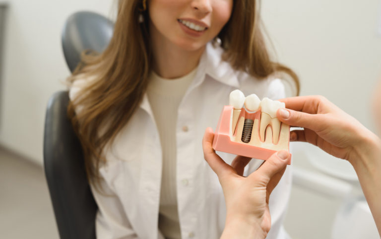 Dentist showing models of dental implants and discussing the benefits