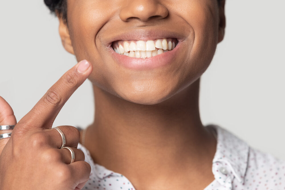 Woman with bright smile from great dental hygiene