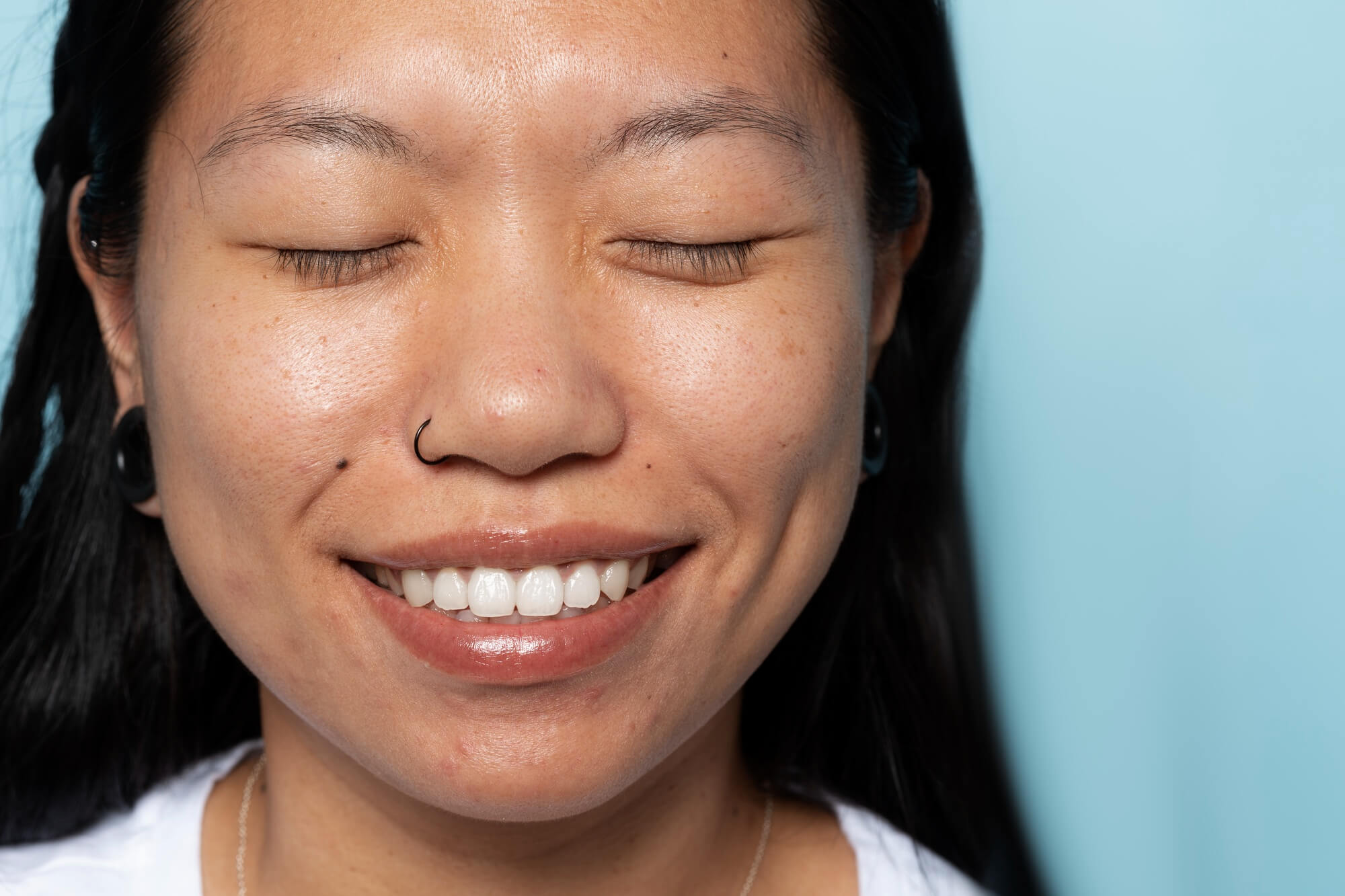 Understanding Gingivitis What You Need to Know at South Anchorage Dental Care