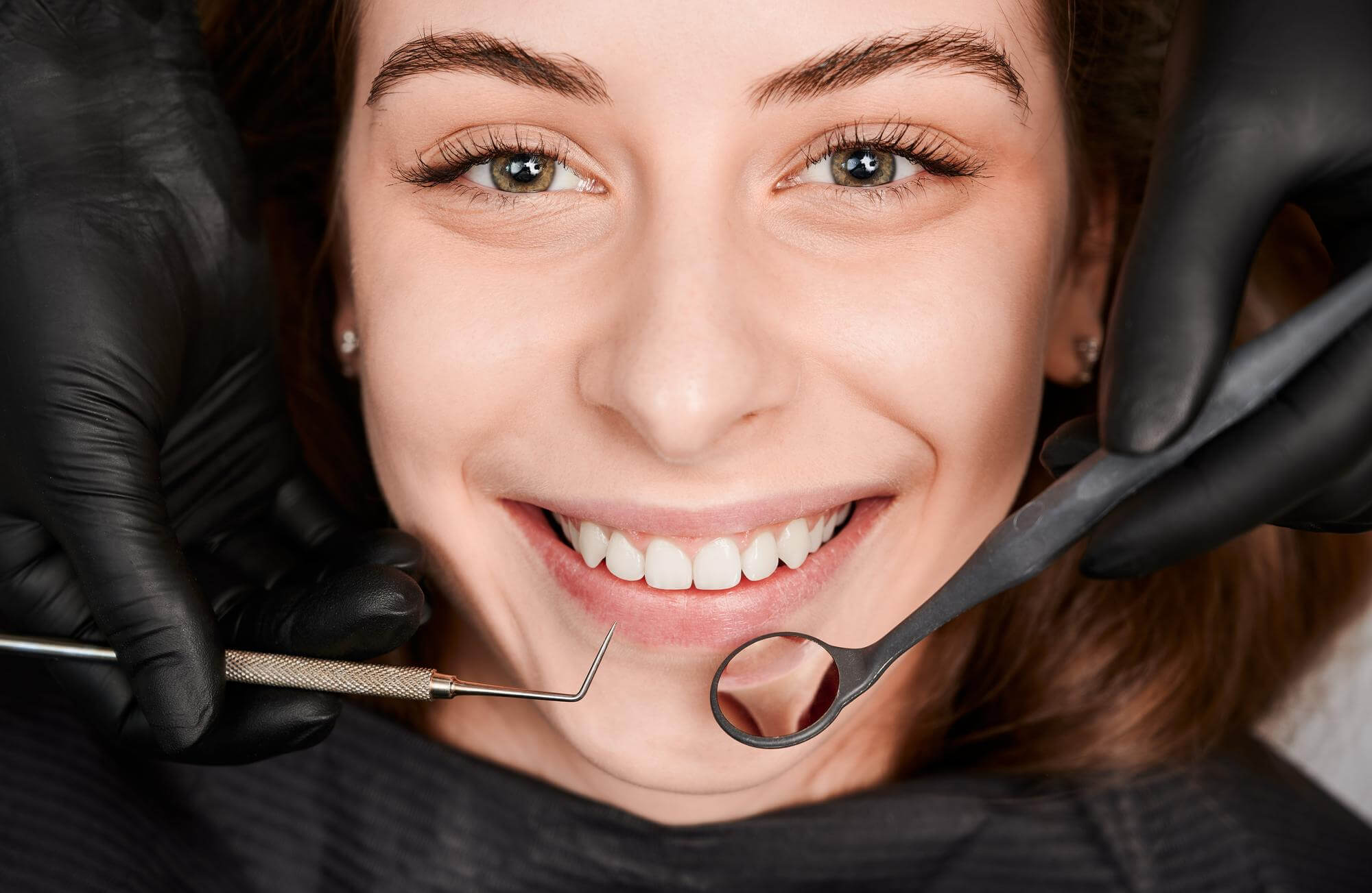 Dental bonding at South Anchorage Dental Center
