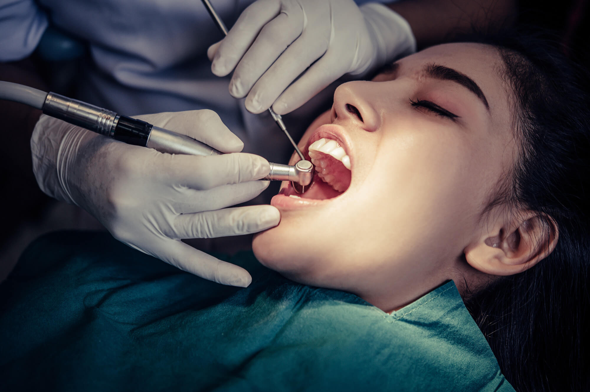 Dental fillings at South Anchorage Dental Center