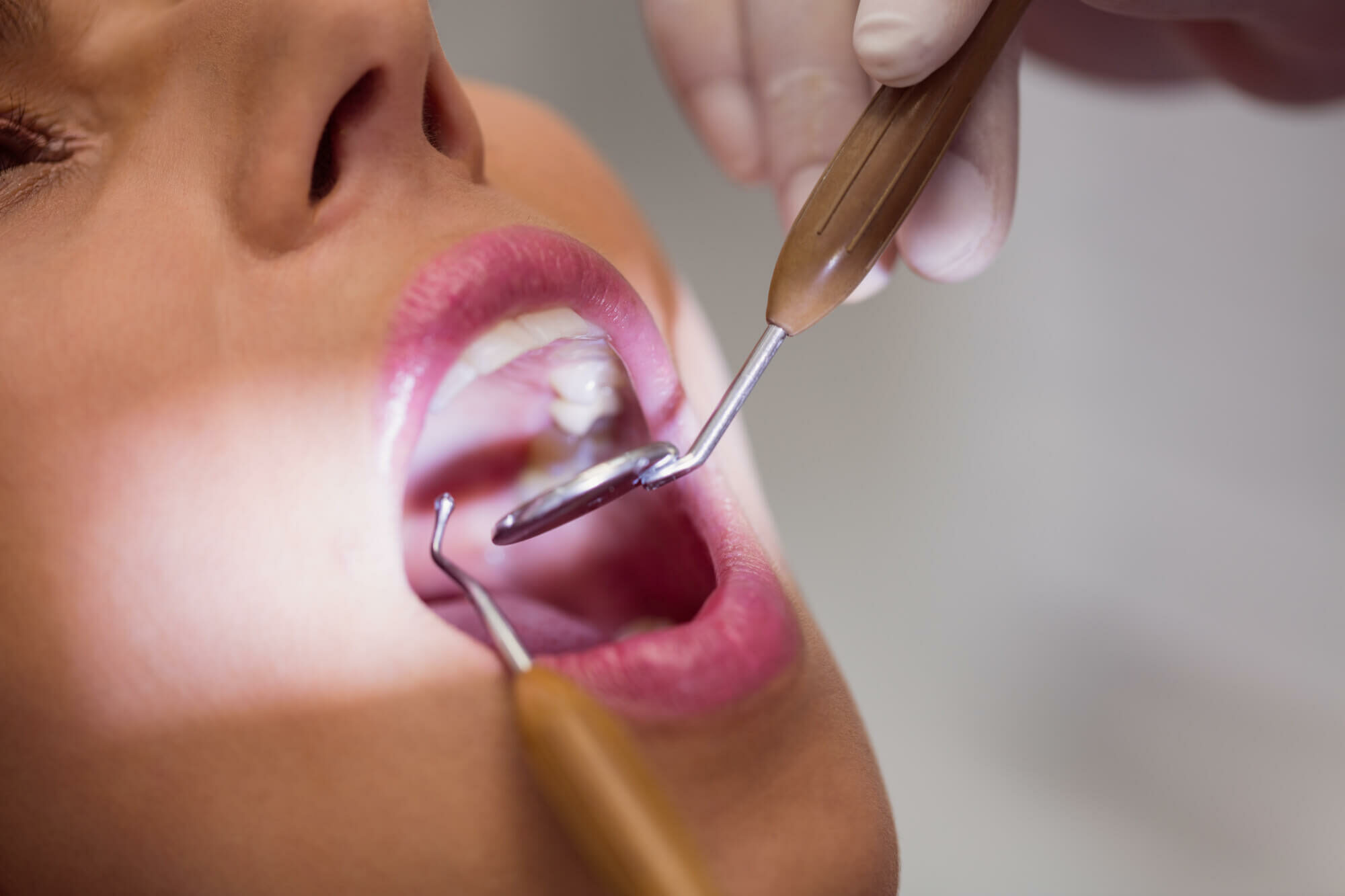 Gum disease and periodontitis treatment at South Anchorage Dental Center