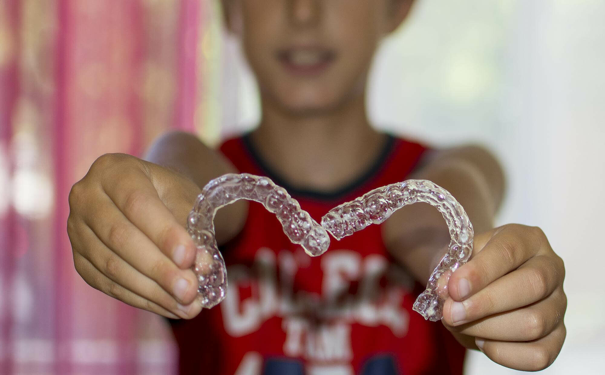 Mouthguards at South Anchorage Dental Center