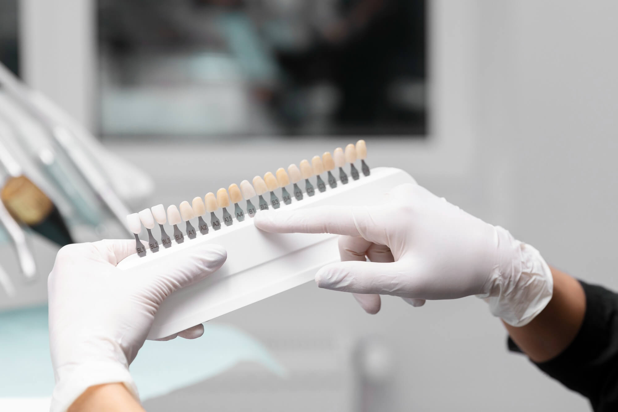 Dental veneers at South Anchorage Dental Center