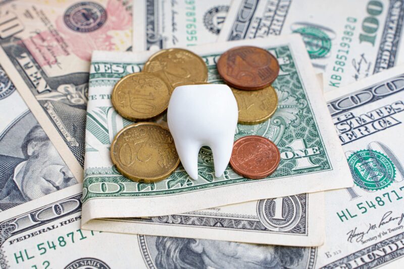 Implants at South Anchorage Dental Center